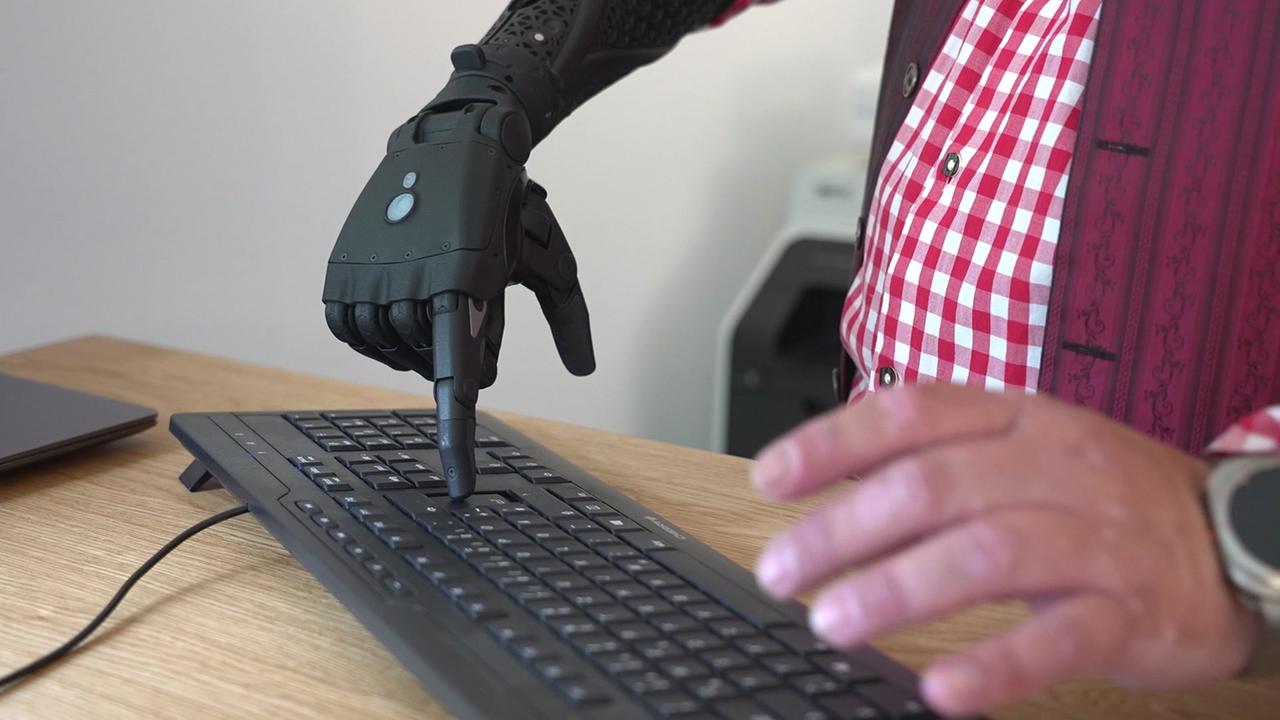 © ORF / Gabi Hanke Man sieht den Mann mit der myoelektrischen Prothese den Computer bedienen