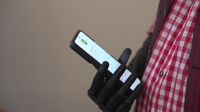 Mit der Prothese kann sogar mühelos das Smartphone bedient werden
