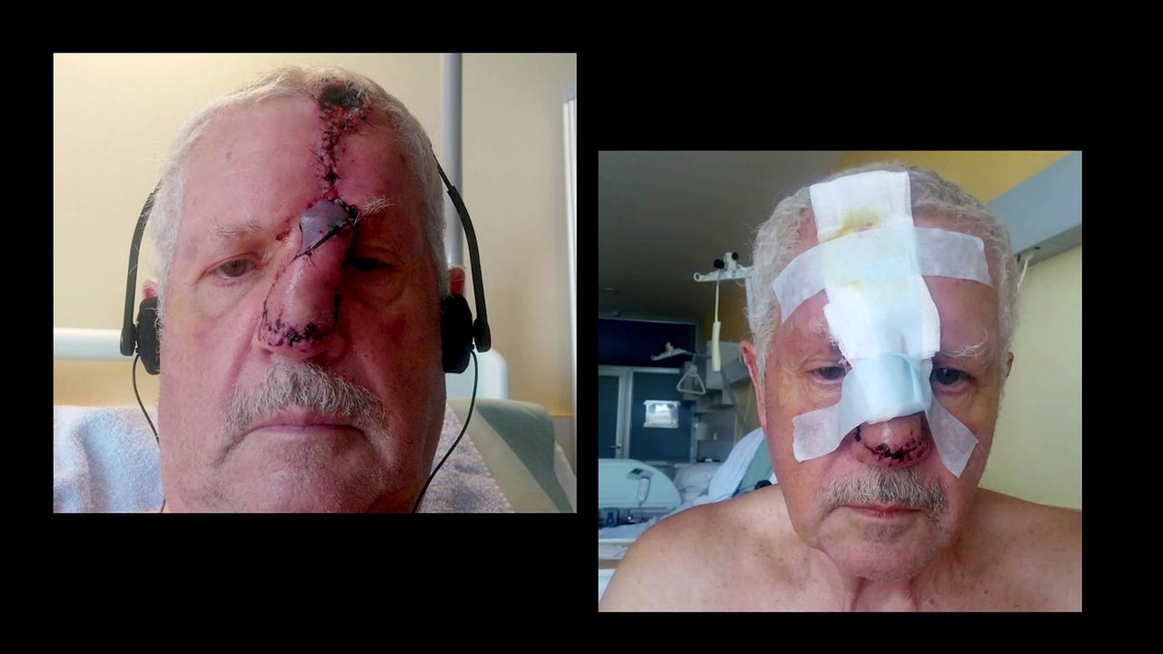 © Privat Auf den beiden Fotos sieht man das Gesicht des Klägers unmittelbar nach der Operation