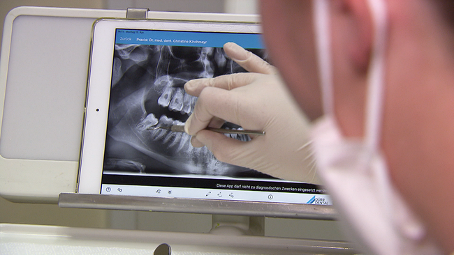 Röntgenbild von Gebiss auf Bildschirm, eine Hand in einem Plastikhandschuh zeigt darauf, unscharfer Kopf im Vordergrund