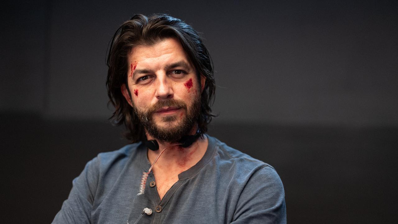 Nahaufnahme von dem bärtigen Eddi Kovac mit Verletzungen im Gesicht vor schwarzem Hintergrund