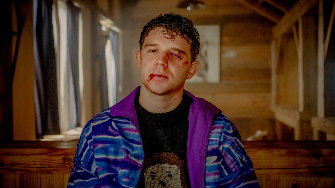 Matin Steiner mit Verletzungen im Gesicht sitzt in einer einfachen Holzhütte.