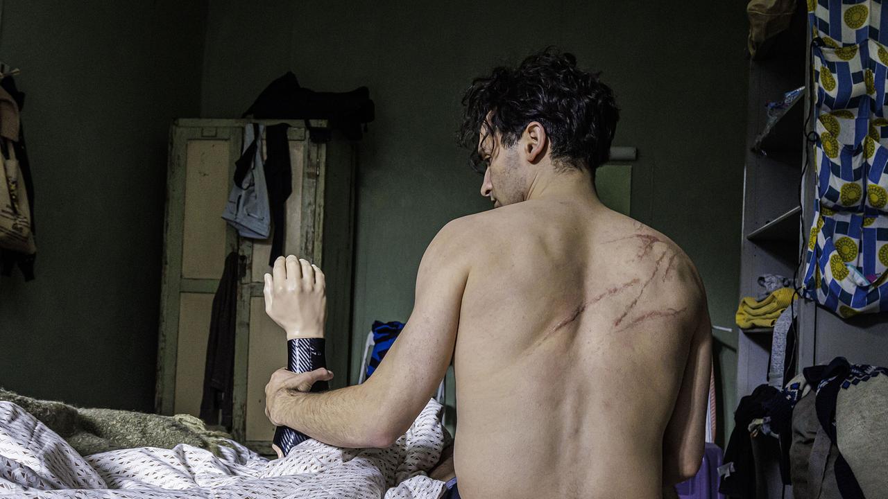 Omar Annan sitzt halbnackt mit Schnuttwunden am Rücken im Bett in einem spärlich eingerichteten Raum und hält einen Armprothese in der Hand.