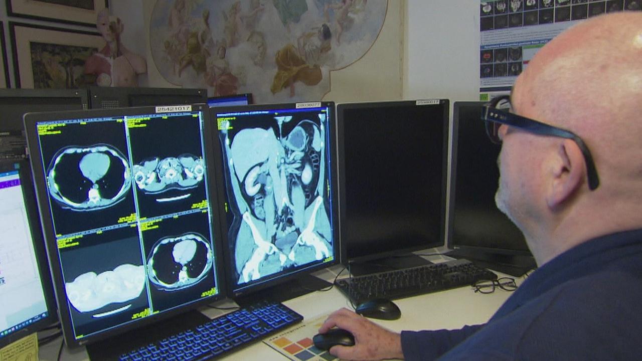 Arzt sieht CT Bilder am Computer an
