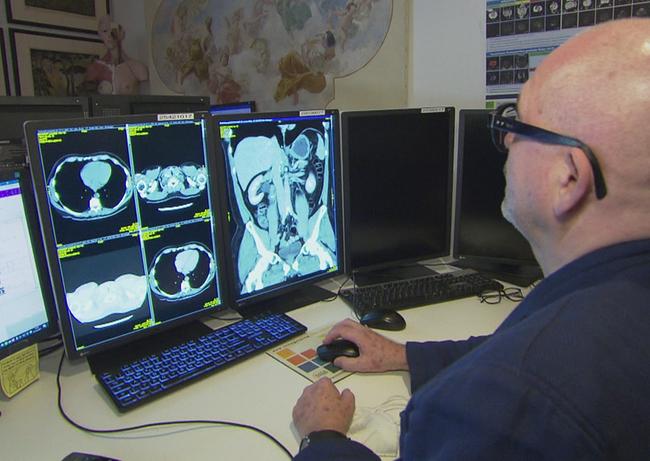 Arzt sieht CT Bilder am Computer an