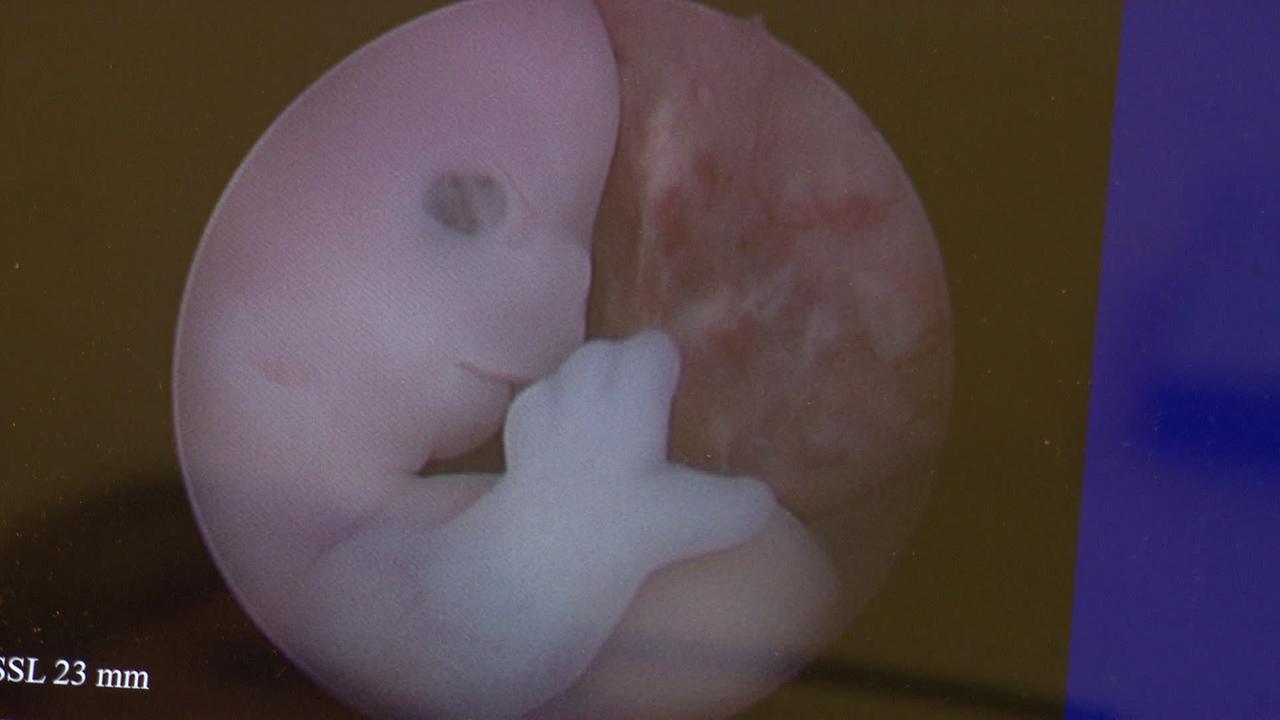 Hochauflösendes Mikroskopbild eines Embryos