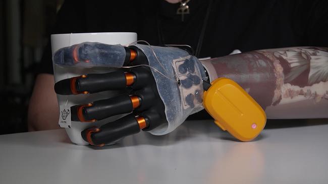 © ORF Armprothese hält Becher