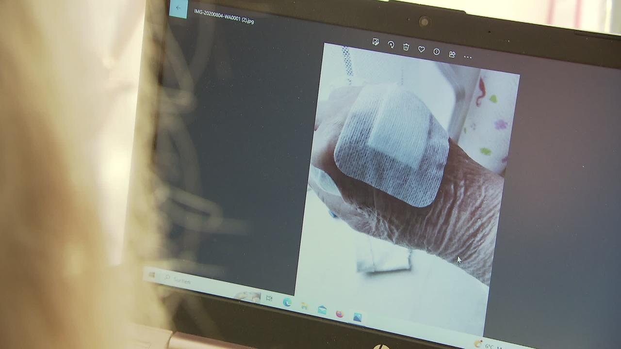 Am Bild ist ein Foto von einer verletzten Hand zu sehen, die mit großen Wundpflastern zugeklebt ist.