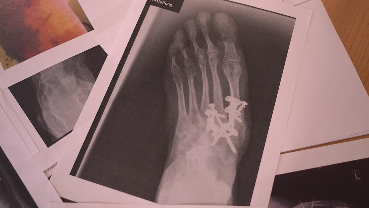 Es liegen Röntgenbilder am Tisch. Am obersten Bild ist ein Fuß zu sehen, in dem einige Schrauben zu sehen sind.