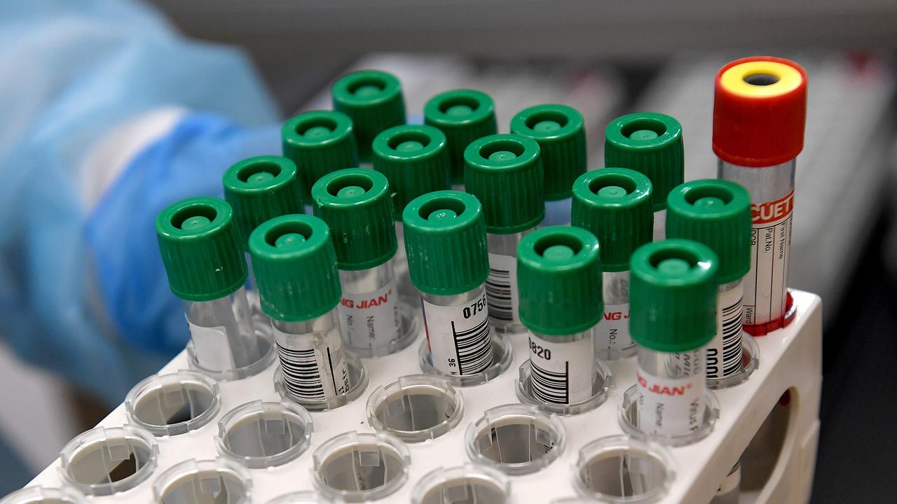 Ein Träger mit Röhrchen mit Proben bei einer Führung durch das Labor der "Lifebrain Group" nach einem im Rahmen eines PG mit dem Titel "30.000 PCR-Tests pro Tag: Lifebrain Group eröffnet eines der modernsten Covid-19-Labors Österreichs" am Dienstag, 15. Dezember 2020, in Wien. 