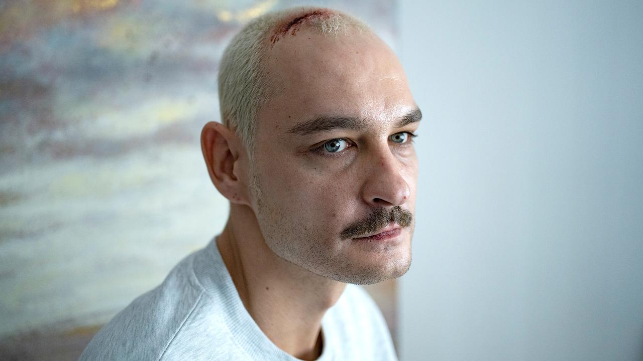 Joe Glauning aka Carsten Kellmann mit blond gefärbten Haaren hat eine Verletzung am Kopf.