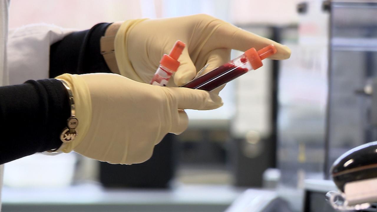 © ORF/Langbein & Partner Röhrchen mit Blut nach der Blutabnahme. Aus der Doku "Cholesterin, Blutdruck und Co - Das Geschäft mit den Grenzwerten"