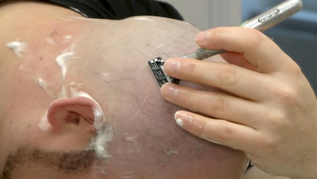 Am Ende greifen viele, die ihre Haare verlieren, selbst zum Rasierer