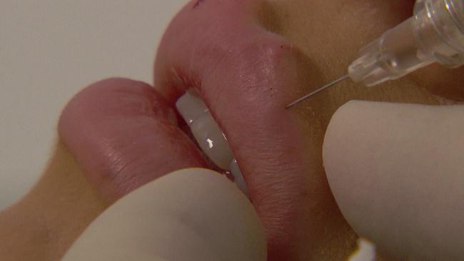 © ORF Das Aufspritzen der Lippen ist am Foto zu sehen